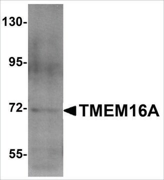 Anti-TMEM16A antibody produced in rabbit affinity isolated antibody, buffered aqueous solution