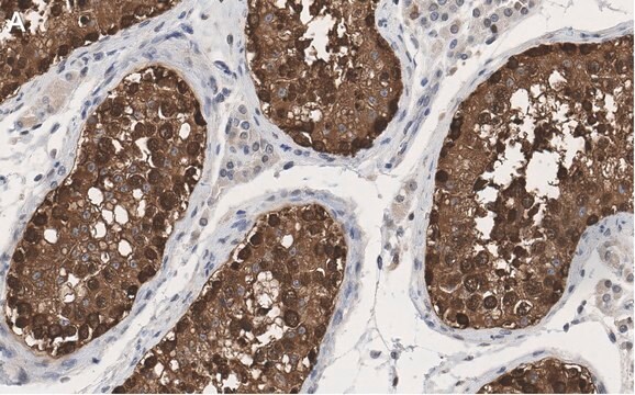 抗HSP90&#945;抗体 クローン4M13 ZooMAb&#174;ウサギモノクローナル recombinant, expressed in HEK 293 cells