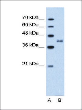 Anti-BDKRB2 antibody produced in rabbit IgG fraction of antiserum