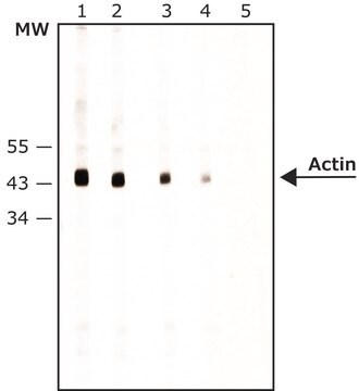 Monoclonal Anti-Actin (20-33) antibody produced in rabbit clone SIG2-AC2, ascites fluid