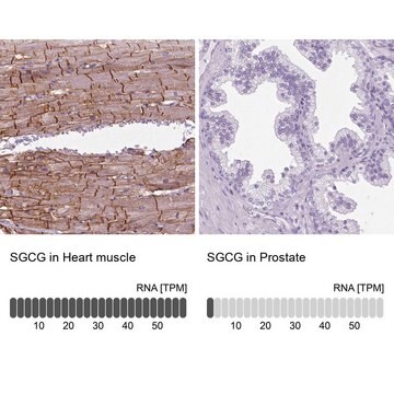 Anti-SGCG antibody produced in rabbit Ab1, Prestige Antibodies&#174; Powered by Atlas Antibodies, affinity isolated antibody, buffered aqueous glycerol solution