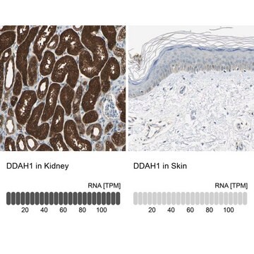 抗DDAH1抗体 ウサギ宿主抗体 Prestige Antibodies&#174; Powered by Atlas Antibodies, affinity isolated antibody, buffered aqueous glycerol solution