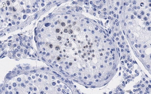 抗p14ARF抗体 クローン4F19 ZooMAb&#174;ウサギモノクローナル recombinant, expressed in HEK 293 cells