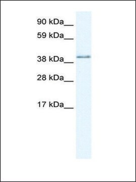 Anti-AKAP7 (AB1) antibody produced in rabbit IgG fraction of antiserum