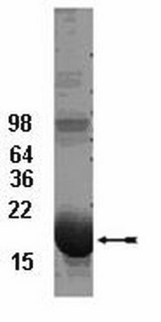 UbcH5b-Konjugatenzym, 100&nbsp;&#181;g The His6-tagged fusion protein of UbcH5b is charge &amp; support ubiquitinylation in vitro. The His6-tagged UbcH5 family members all appear to form thiol ester conjugates with ubiquitin at a similar rate under similar conditions.