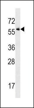 ANTI-ACTIVIN RECEPTOR TYPE IA (ACVR1) (CENTER R147) antibody produced in rabbit IgG fraction of antiserum, buffered aqueous solution