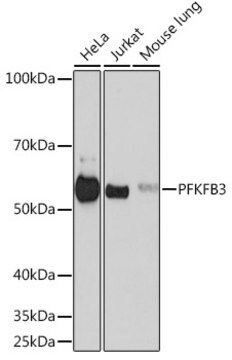 Anti-PFKFB3 Antibody, clone 7X10D9, Rabbit Monoclonal