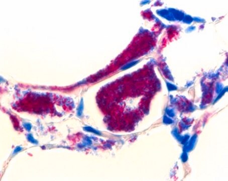 AFB-Color-Färbekit for the microscopic investigation of acid-fast bacteria (cold staining)