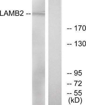 Anti-LAMB2 antibody produced in rabbit affinity isolated antibody