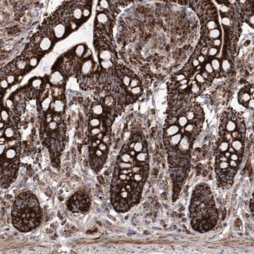 Anti-SEMA6A antibody produced in rabbit Prestige Antibodies&#174; Powered by Atlas Antibodies, affinity isolated antibody, buffered aqueous glycerol solution