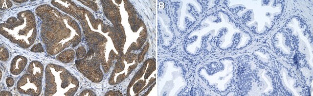 Anti-MXRA8 Antibody, clone 1F4 ZooMAb&#174; Rabbit Monoclonal recombinant, expressed in HEK 293 cells