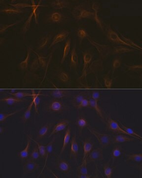 Anti-Tubulin beta-1 chain Antibody, clone 2Z6P1, Rabbit Monoclonal