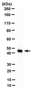 Anticorps anti-actine, muscle lisse, clone&nbsp;ASM-1/1A4 clone ASM-1 (1A4), from mouse