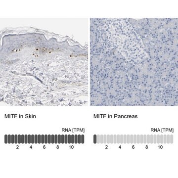 抗-MITF 兔抗 Prestige Antibodies&#174; Powered by Atlas Antibodies, affinity isolated antibody, buffered aqueous glycerol solution