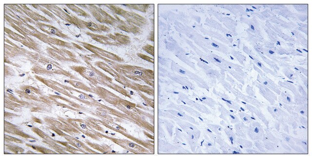 Anti-KANK2 antibody produced in rabbit affinity isolated antibody