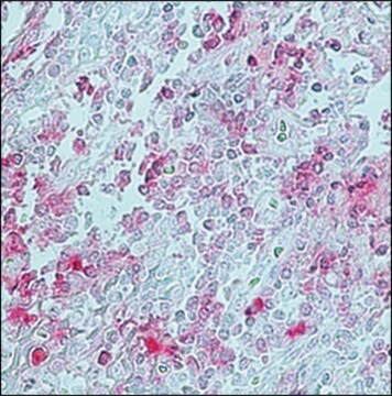 Monoclonal Anti-Rabbit IgG (&#947;-chain specific)&#8722;Alkaline Phosphatase antibody produced in mouse clone RG-96, purified immunoglobulin, buffered aqueous glycerol solution