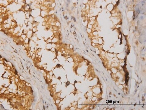 Monoclonal Anti-NME2 antibody produced in mouse clone 1D3, purified immunoglobulin, buffered aqueous solution