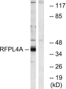 Anti-RFPL4A antibody produced in rabbit affinity isolated antibody