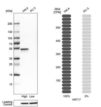 抗JUP ウサギ宿主抗体 Ab1, Prestige Antibodies&#174; Powered by Atlas Antibodies, affinity isolated antibody, buffered aqueous glycerol solution