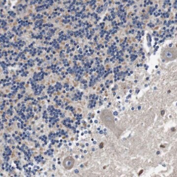 Anti-LRP4 antibody produced in rabbit Prestige Antibodies&#174; Powered by Atlas Antibodies, affinity isolated antibody, buffered aqueous glycerol solution