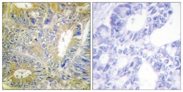 Anti-Desmin antibody produced in rabbit affinity isolated antibody