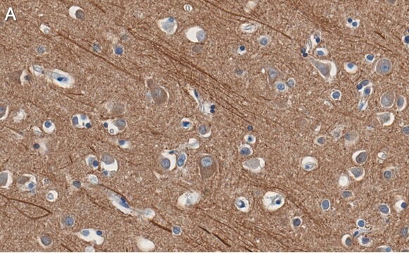 Anti-Presenilin-1 Antibody, clone 2O13 ZooMAb&#174; Rabbit Monoclonal recombinant, expressed in HEK 293 cells