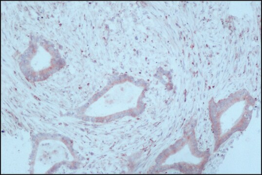 色氨酸羟化酶单克隆抗体 小鼠抗 clone WH-3, ascites fluid