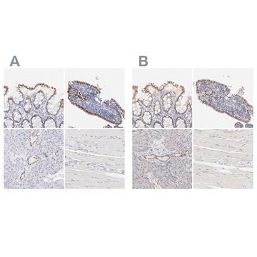 Anti-ELF3 antibody produced in rabbit Ab2, Prestige Antibodies&#174; Powered by Atlas Antibodies, affinity isolated antibody, buffered aqueous glycerol solution