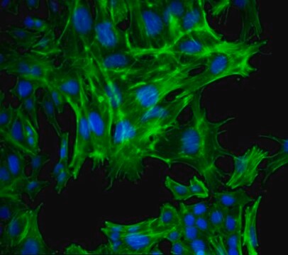 Línea celular de carcinoma mamario de ratón AT-3 AT-3 mouse mammary tumor cell line may be used to develop mouse models for mammary cancer studies.