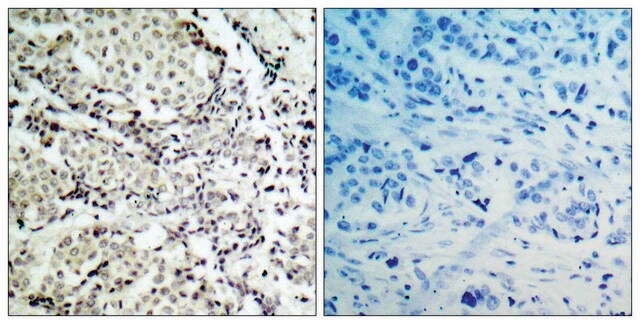 Anti-MKK6 antibody produced in rabbit affinity isolated antibody