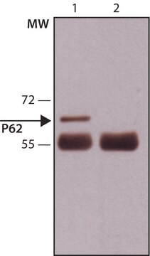 Anti-p62/SQSTM1 (C-terminal) antibody produced in rabbit affinity isolated antibody, buffered aqueous solution