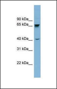 Anti-ACHE antibody produced in rabbit affinity isolated antibody