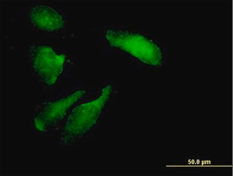 Anti-STK11 antibody produced in mouse purified immunoglobulin, buffered aqueous solution