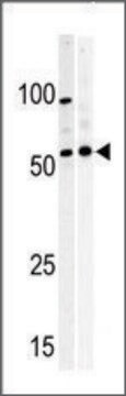 Anti-PKMYT1 (C-term) antibody produced in rabbit IgG fraction of antiserum, buffered aqueous solution