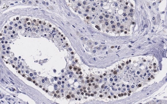 Anti-Smad1 Antibody, clone 1B9 ZooMAb&#174; Rabbit Monoclonal recombinant, expressed in HEK 293 cells