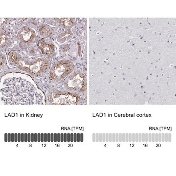 Anti-LAD1 antibody produced in rabbit Prestige Antibodies&#174; Powered by Atlas Antibodies, affinity isolated antibody, buffered aqueous glycerol solution