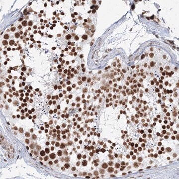 Anti-ZNF638 antibody produced in rabbit Prestige Antibodies&#174; Powered by Atlas Antibodies, affinity isolated antibody, buffered aqueous glycerol solution