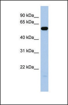 Anti-ILDR1 antibody produced in rabbit affinity isolated antibody