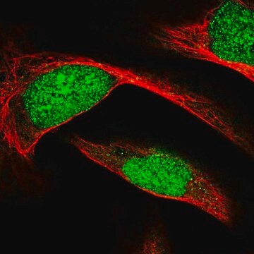 Anti-ECE2 antibody produced in rabbit Prestige Antibodies&#174; Powered by Atlas Antibodies, affinity isolated antibody