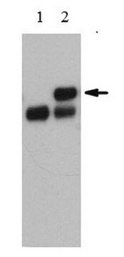 Anti-TOE1 (Ab-86) from rabbit, purified by affinity chromatography