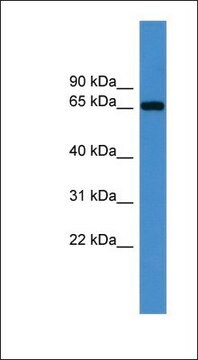 Anti-IGF2BP3 antibody produced in rabbit affinity isolated antibody