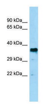 Anti-BSG antibody produced in rabbit affinity isolated antibody