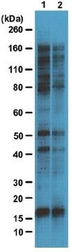 Anticuerpo anti-O-GlcNAc, clon 9D1.E4(10) clone 9D1.E4(10), from mouse