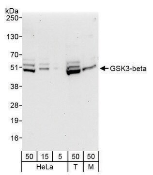 Rabbit anti-GSK3-beta Antibody, Affinity Purified Powered by Bethyl Laboratories, Inc.