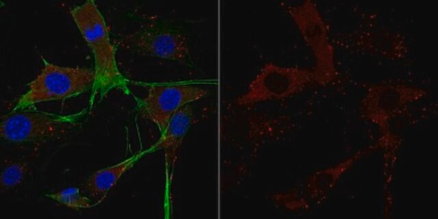 抗-丝切蛋白-1抗体 from rabbit, purified by affinity chromatography