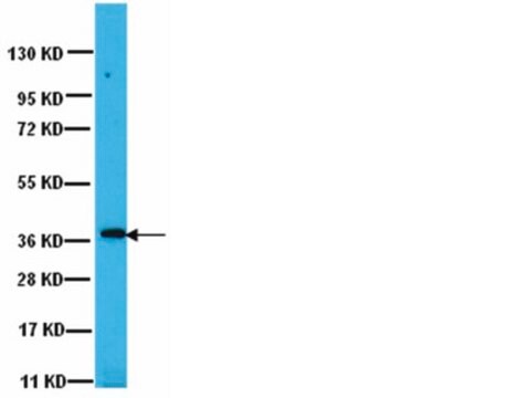 Przeciwciało anty-PP1γ1 Upstate&#174;, from rabbit