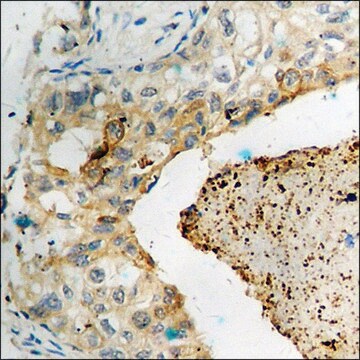 Anti-phospho-GluR1 (pSer849) antibody produced in rabbit affinity isolated antibody