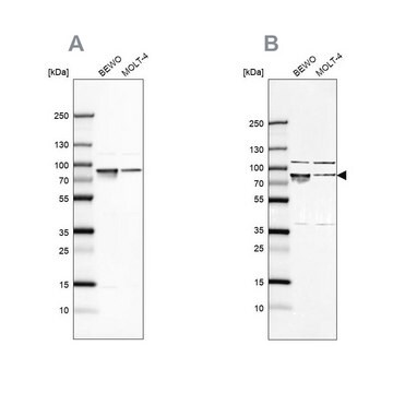 Anti-HSPA5 antibody produced in rabbit Prestige Antibodies&#174; Powered by Atlas Antibodies, affinity isolated antibody, buffered aqueous glycerol solution