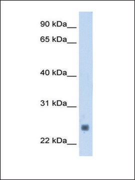 Anti-TNNI2 antibody produced in rabbit IgG fraction of antiserum