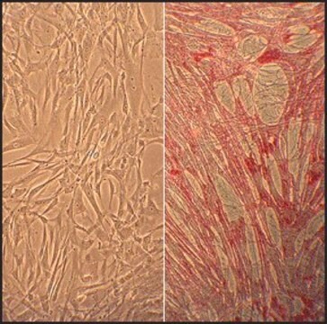 Human Umbilical Vein Smooth Muscle Cells: HUVSMC, neonatal